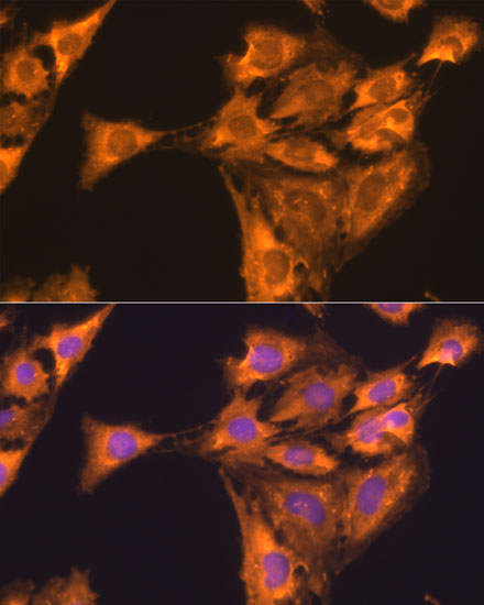 RPL23 Polyclonal Antibody (E-AB-62306)