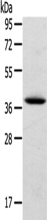 TPM2 Polyclonal Antibody (E-AB-15658)