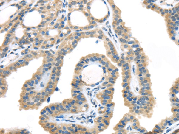VGF Polyclonal Antibody (E-AB-17546)
