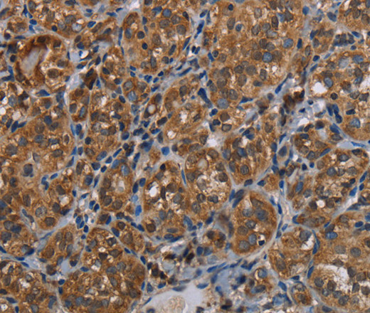 LLGL1 Polyclonal Antibody (E-AB-13382)