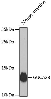 GUCA2B Polyclonal Antibody (E-AB-62780)