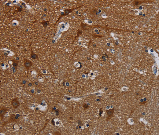 PCDHB15 Polyclonal Antibody (E-AB-13497)