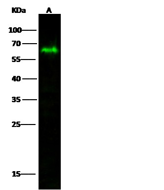 Recombinant MICB Monoclonal Antibody (AN300058P)