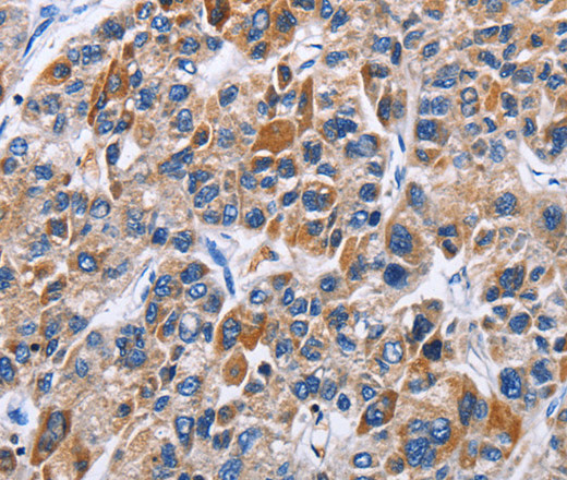 ENPP5 Polyclonal Antibody (E-AB-10302)