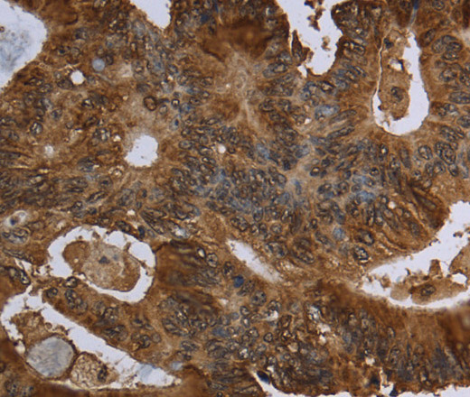 HPGD Polyclonal Antibody (E-AB-15101)