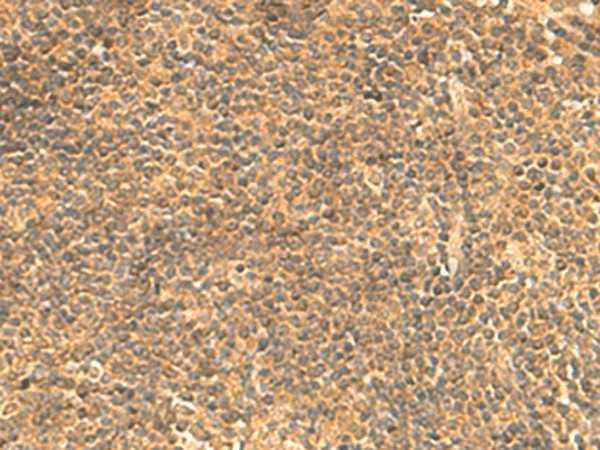 FAM186B Polyclonal Antibody (E-AB-52775)