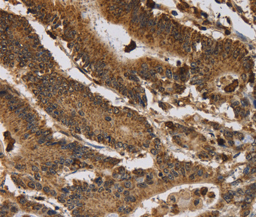 ITPR3 Polyclonal Antibody (E-AB-13346)