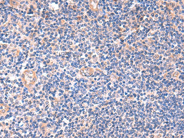 ZNF256 Polyclonal Antibody (E-AB-19057)