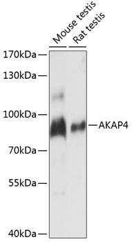 AKAP4 Polyclonal Antibody (E-AB-65117)