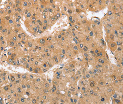 ATG12 Polyclonal Antibody (E-AB-10815)