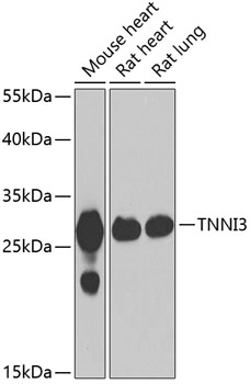 TNNI3 Polyclonal Antibody (E-AB-61454)