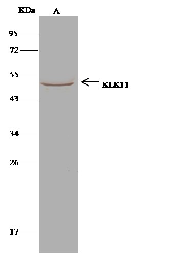 Recombinant KLK-11/Kallikrein-11 Monoclonal Antibody (AN300204P)