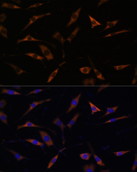 RPL28 Polyclonal Antibody (E-AB-65196)