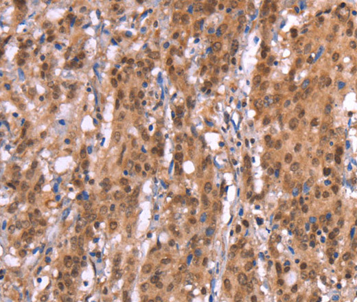 AMER1 Polyclonal Antibody (E-AB-13234)