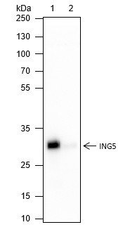Recombinant ING5 Monoclonal Antibody (AN301566L)