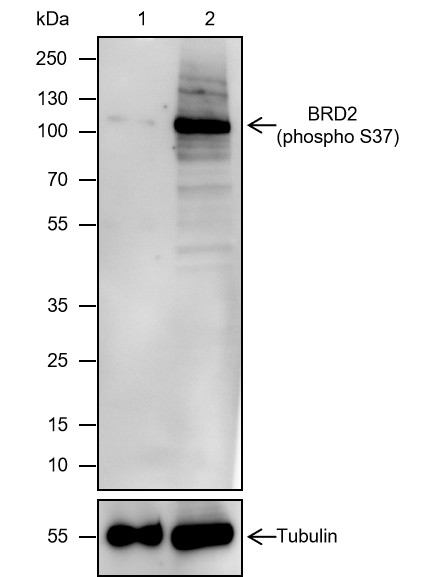 Recombinant Phospho-BRD2 (S37) Monoclonal Antibody (AN302085L)