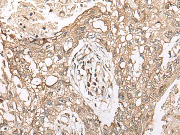 M1AP Polyclonal Antibody (E-AB-17752)