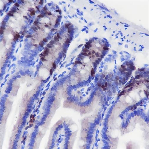 Recombinant TPX2 Monoclonal Antibody (AN301679L)