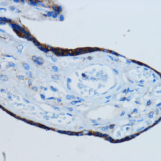MMP2 Polyclonal Antibody (E-AB-61181)