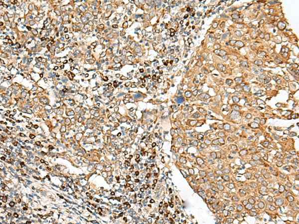 STT3A Polyclonal Antibody (E-AB-52663)