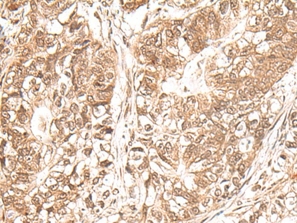 USP16 Polyclonal Antibody (E-AB-17930)