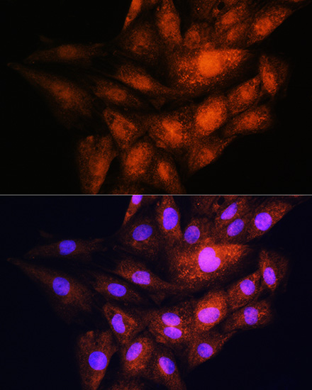 YWHAE Polyclonal Antibody (E-AB-60158)