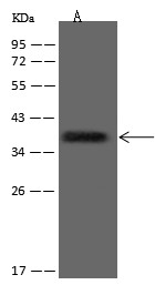 CD20/MS4A1 Monoclonal Antibody (AN200196P)