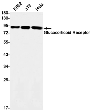 Recombinant Glucocorticoid Receptor Monoclonal Antibody (E-AB-81561)