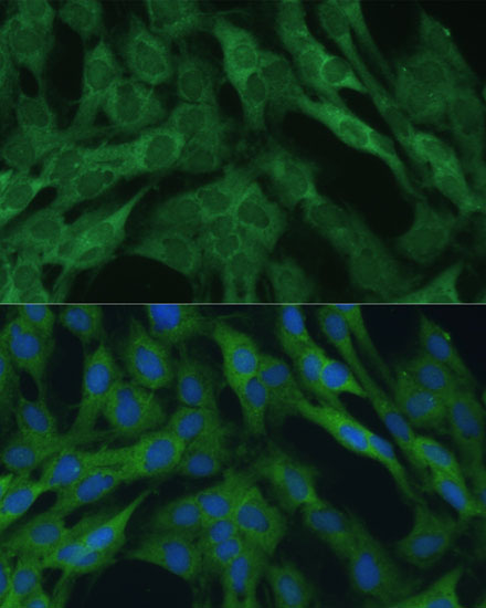 (KO Validated) IDH1 Polyclonal Antibody (E-AB-64515)