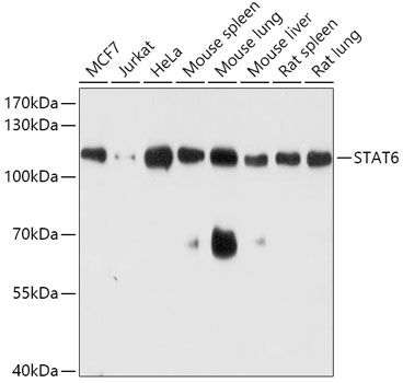 STAT6 Polyclonal Antibody (E-AB-65706)