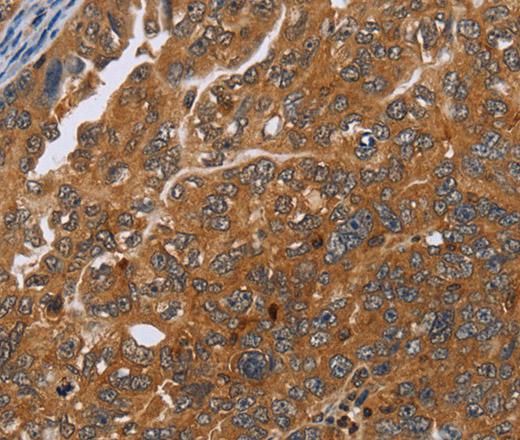 ADAMTS15 Polyclonal Antibody (E-AB-10171)