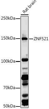 ZNF521 Polyclonal Antibody (E-AB-92306)