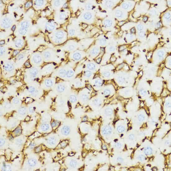 YKL-40 / CHI3L1 Polyclonal Antibody (E-AB-67558)