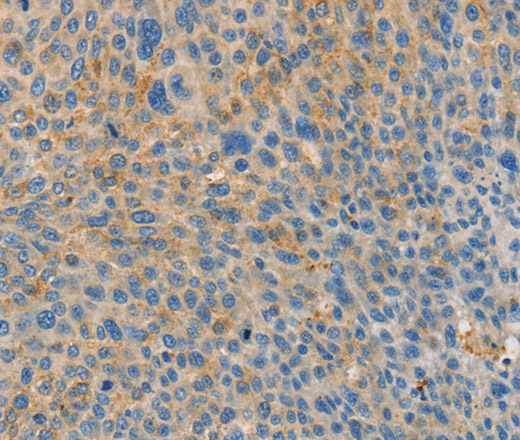BRCA1 Polyclonal Antibody (E-AB-10188)
