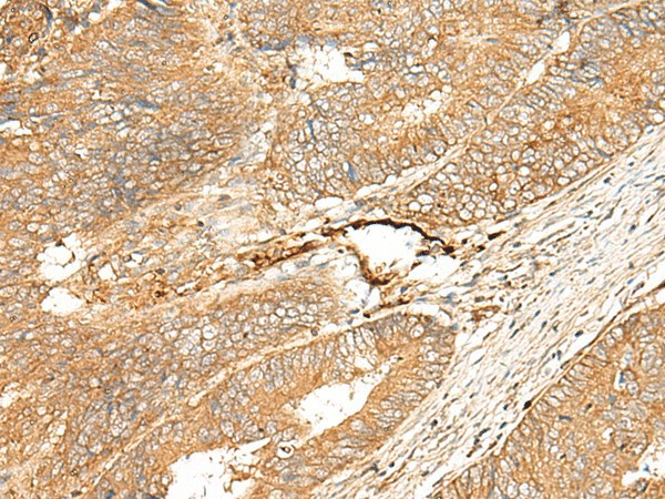 ADGRF5 Polyclonal Antibody (E-AB-18017)