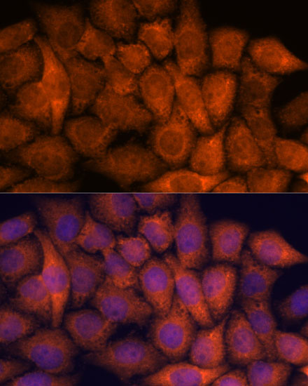 RPAP3 Polyclonal Antibody (E-AB-66471)