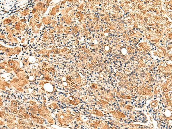 PAFAH1B2 Polyclonal Antibody (E-AB-52863)