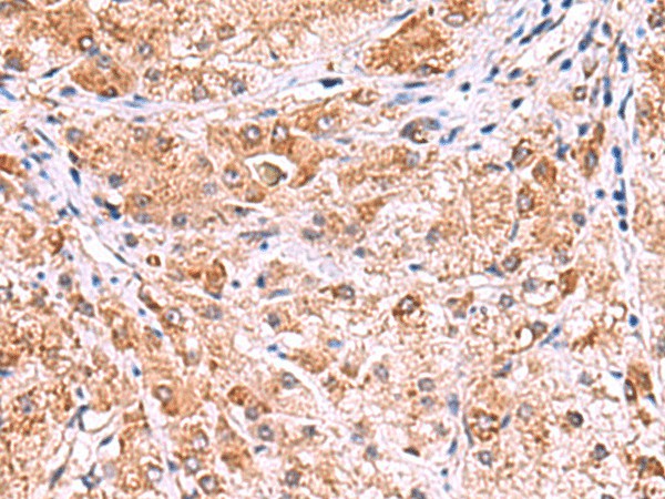 UXS1 Polyclonal Antibody (E-AB-52942)