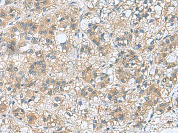 RAB39A Polyclonal Antibody (E-AB-53095)
