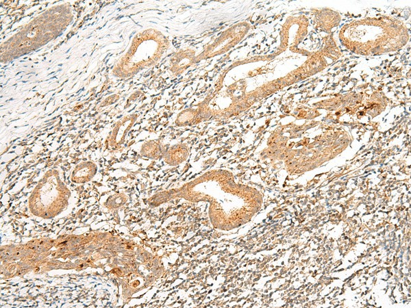 HLA-G Polyclonal Antibody (E-AB-18031)