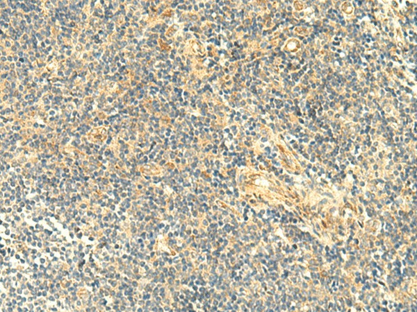 ASB6 Polyclonal Antibody (E-AB-18933)