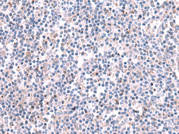 KCNK10 Polyclonal Antibody (E-AB-52077)