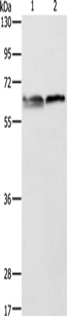 ALAS2 Polyclonal Antibody (E-AB-10763)