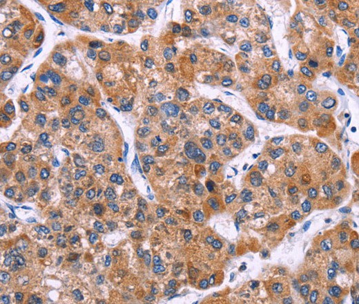 MSMO1 Polyclonal Antibody (E-AB-16412)