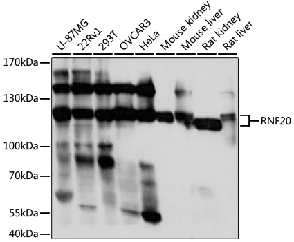 RNF20 Polyclonal Antibody (E-AB-91760)