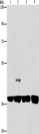 SERPINA9 Polyclonal Antibody (E-AB-13030)