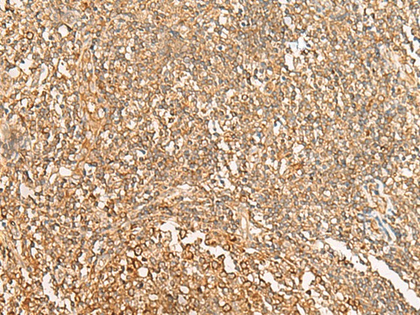 NARS Polyclonal Antibody (E-AB-52760)