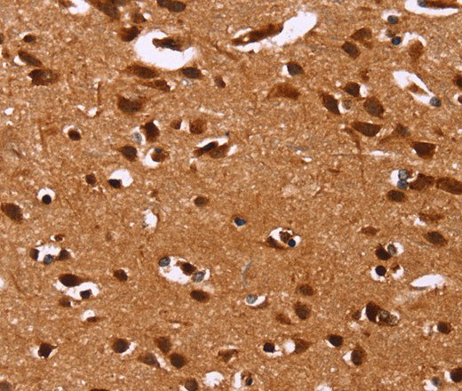 HRK Polyclonal Antibody (E-AB-16495)
