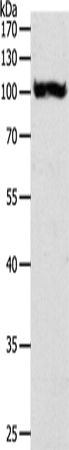 PYGB Polyclonal Antibody (E-AB-12258)