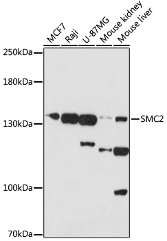 SMC2 Polyclonal Antibody (E-AB-91943)